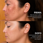 Crema illuminante con acido Tranexamico