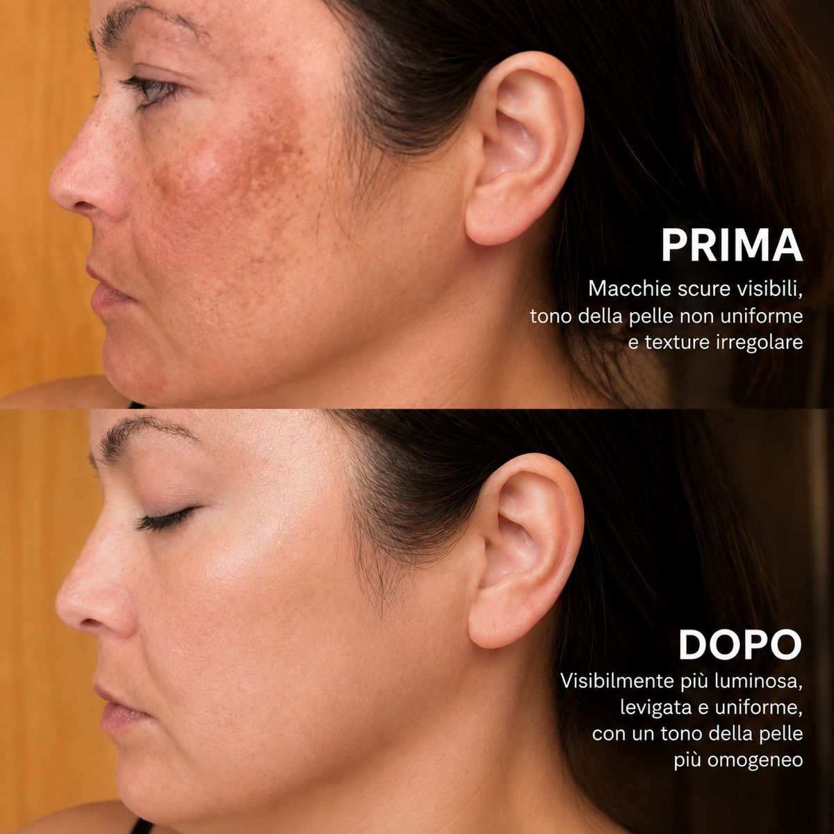 Crema illuminante con acido Tranexamico