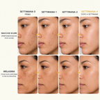 Crema illuminante con acido Tranexamico